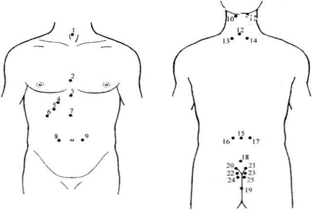 Лікування алергії.