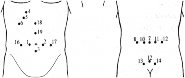 Лікування закрепів