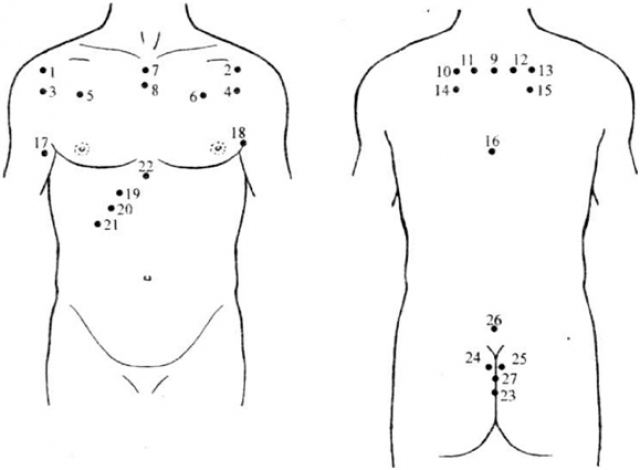 Гірудотерапія при бронхіті