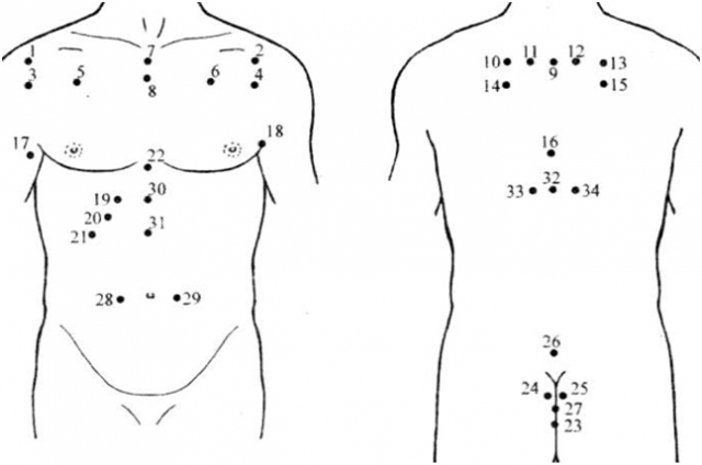 Схема поставки п'явок при бронхіальній астмі